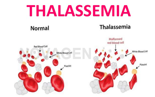 Người mang gen bệnh Thalassemia có thể sinh con khỏe mạnh được không